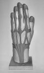 7 of 9 Borg Hand Implant